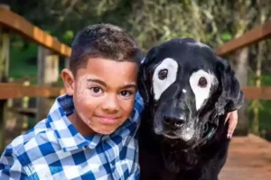 vitiligo autoestima